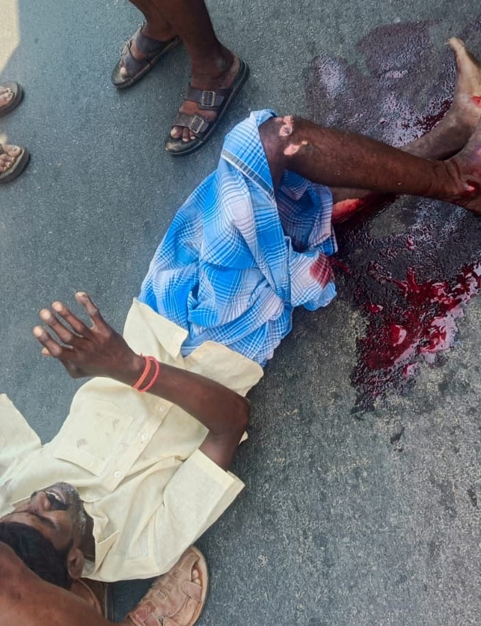 குஜிலியம்பாறை பிரதான சாலையில் அடிக்கடி விபத்து ! கண்டுகொள்ளாத அதிகாரிகள் !